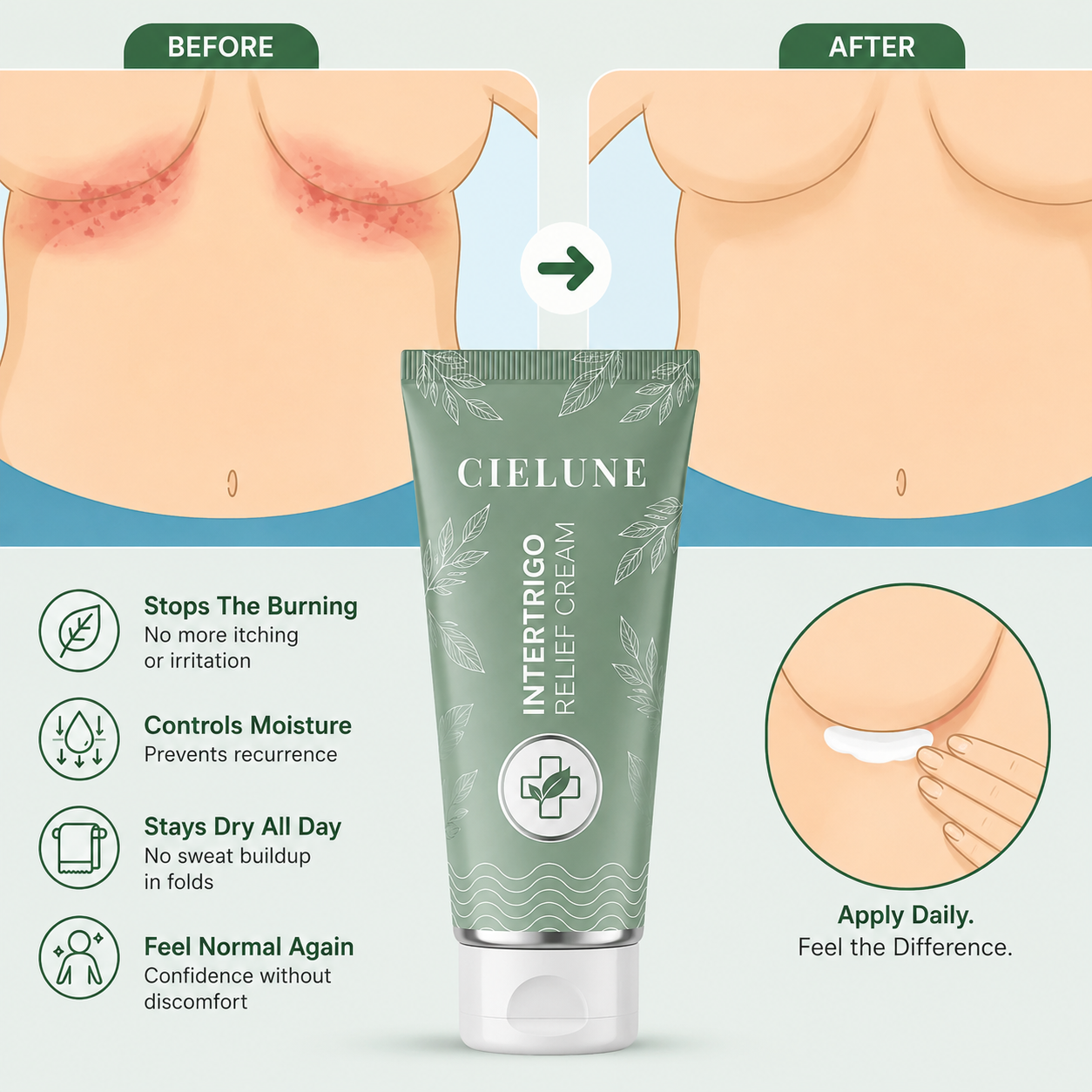 Cielune™ Intertrigo Cream